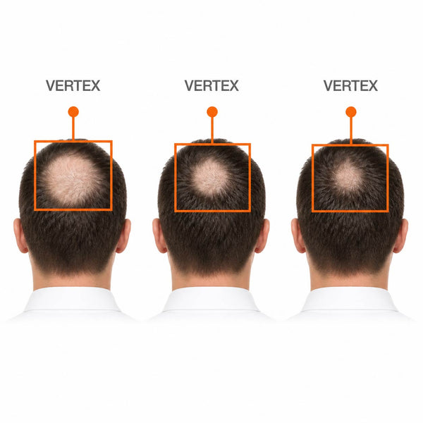 FOLIGAIN® Haarwuchsmittel-Set für Männer