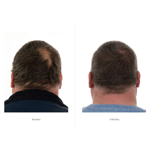 FOLIGAIN Hair Growth Shampoo + Conditioner Kit For Men (Standalone) - FOLIGAIN CH
